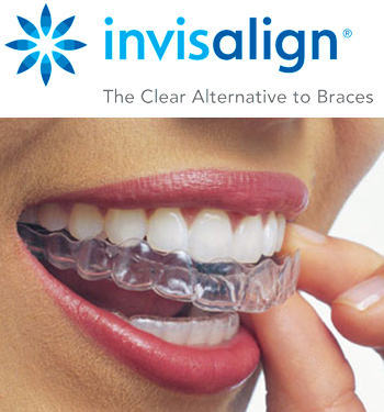 Invisalign Invisible Braces, North York