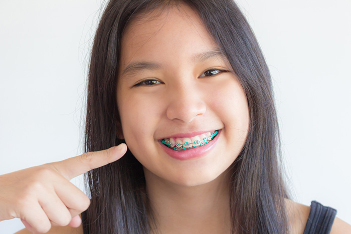 orthodontics---girl---700x467